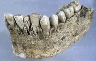 Seashell Mayan Implant