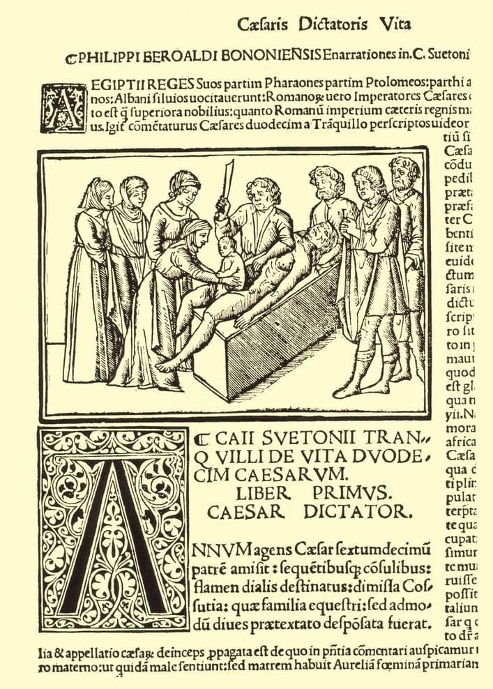 First depiction of Caesar Caesarian Birth